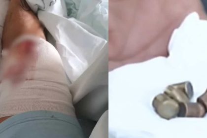 Αδέσποτη σφαίρα καρφώθηκε σε πόδι άνδρα στα Άνω Λιόσια