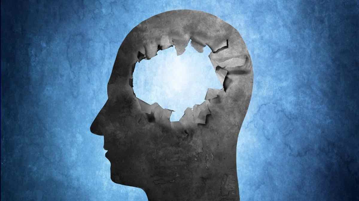 Αλτσχάιμερ: Δεν έχει σχέση με τα γηρατειά – 3 σημαντικοί παράγοντες για την εμφάνισή του